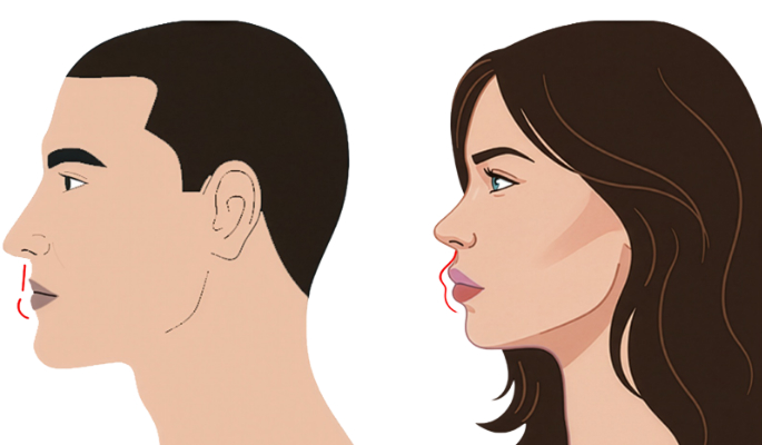 Understanding the Feminization Lip Lift Procedure